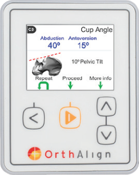 orthalign device